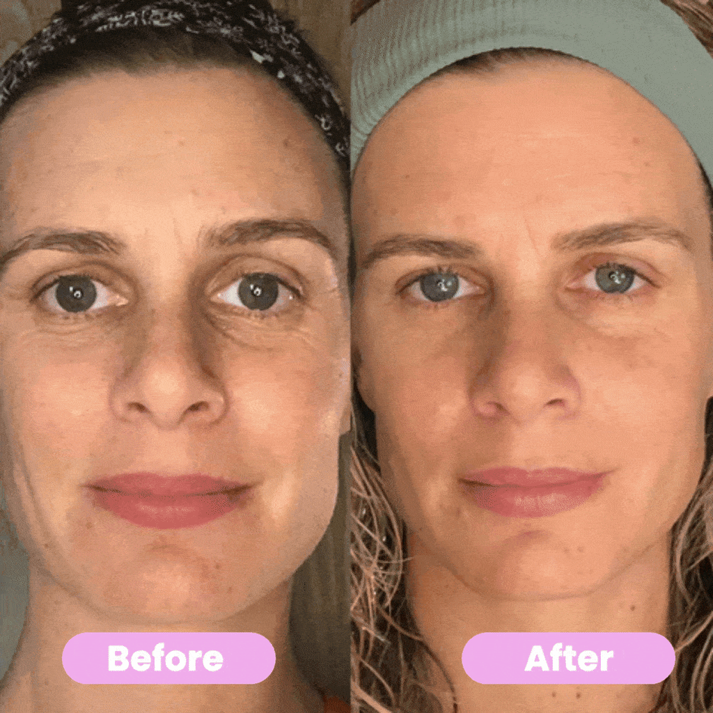 Led Facial Sculptor